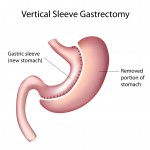 12176784_xl ObesityHelp.com